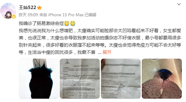 演员杜淳妻子王灿-康兴医疗器械官网